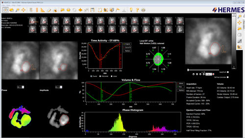 Software de análisis - Hermes Medical Solutions, Inc - para informes / de diagnóstico / de adquisición