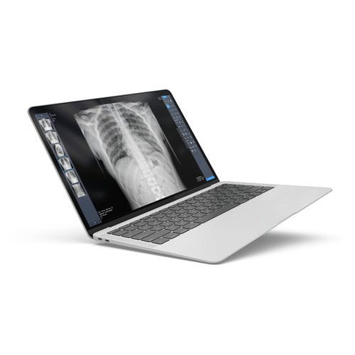 Software de radiografía - ExamVue Duo - JPI Healthcare Solutions - de análisis / de gestión / de diagnóstico