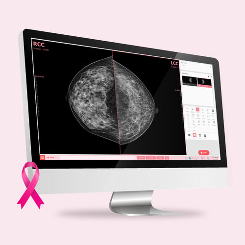 Software para mamografía - VXvue Mammo - Vieworks - de gestión / visualizador / de adquisición