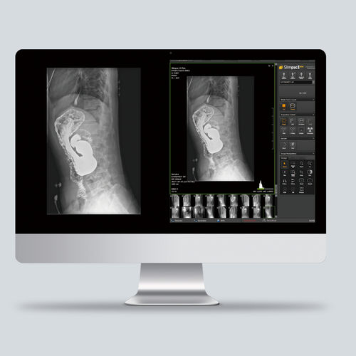 Software de radiografía - Slimpac Ⅱ Plus - Vieworks - de control / visualizador / de diagnóstico