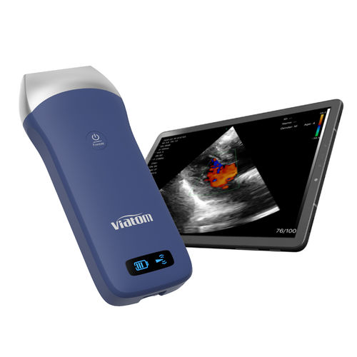 Ecógrafo de mano - Shenzhen Viatom Technology Co., Ltd. - para ecografía polivalente / para ecografía pulmonar / blanco y negro