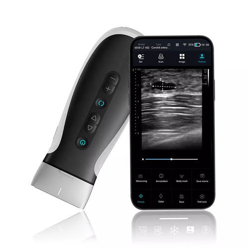 Ecógrafo de mano - MX9V - Shenzhen Viatom Technology Co., Ltd. - para ecografía polivalente / blanco y negro / doppler-color