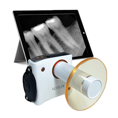 Sistema de radiografía intraoral analógica o digital - MobileX  - Denterprise - portátil