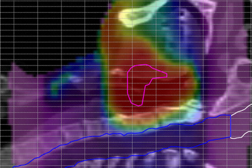 Software médico - ScandiDos - clínico / de anatomía / de análisis