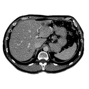 Software de tratamiento - MeVis Medical Solutions AG - de educación / médico / para imágenes médicas