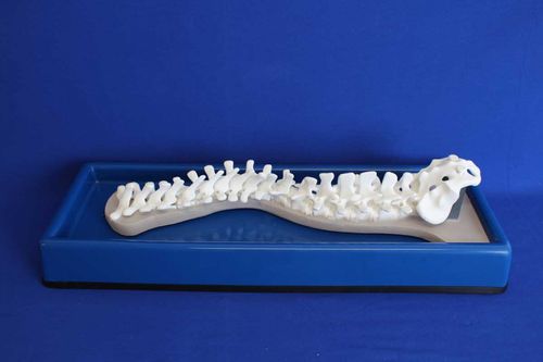 Modelo anatómico de columna vertebral - SDEP - Créaplast - para escoliosis