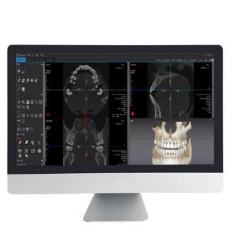 Software de análisis - Dentiq 3D - 3D Industrial Imaging, Co., Ltd. - de visualización 3D / de diagnóstico / de planificación de tratamiento