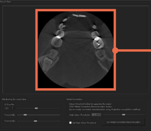 Software de análisis de imágenes - DentiqRecon - 3D Industrial Imaging, Co., Ltd. - médico / TDM