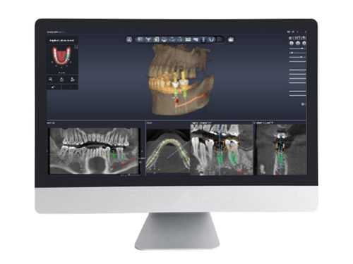 Software de planificación - Dentiq Guide - 3D Industrial Imaging, Co., Ltd. - de gestión de datos / de diseño / de captura