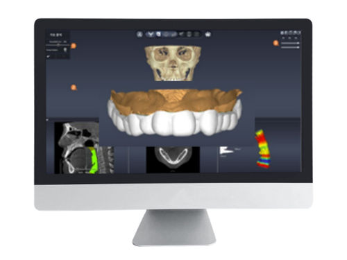Software de diseño - DentiqAir - 3D Industrial Imaging, Co., Ltd. - médico / para odontología