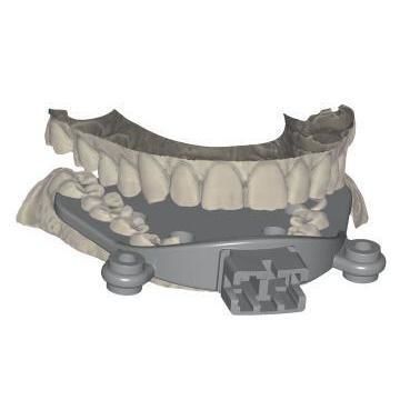 Módulo de software de importación - 42191 - Champions Implants GmbH - de verificación / de registro / para odontología