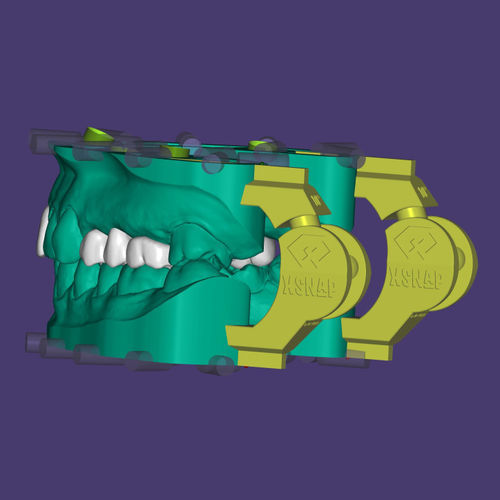 Módulo de software de implantología dental - xSNAP® - Champions Implants GmbH - de modelado