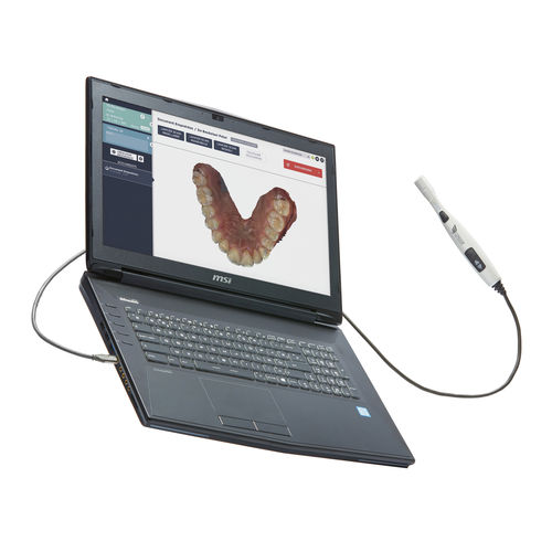 Escáner 3D para clínica dental - CONDOR - Condor - intraoral