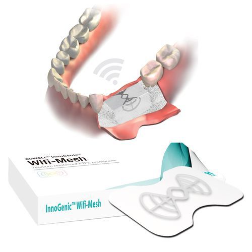 Matriz tisular cirugía dental - InnoGenic™ Wifi-Mesh - Cowellmedi - PTFE