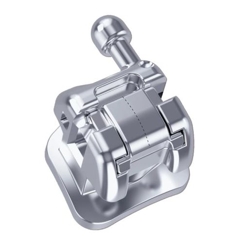 Bracket de metal - Thomas M - Creative Dental