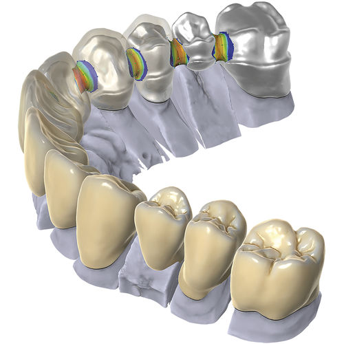 Software de CAD - exocad - DOF, Inc. - para odontología