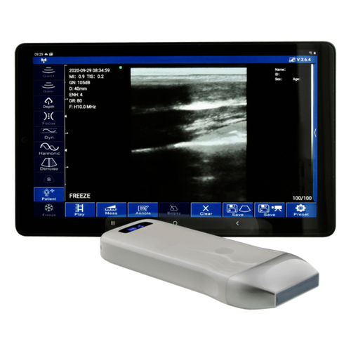 Ecógrafo de mano - WU9 series - Garda Laser - para ecografía polivalente / blanco y negro / sonda todo en uno