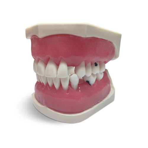 Modelo anatómico de encías - E56 - GF DENTAL - de dentadura / para cuidados dentales / de formación