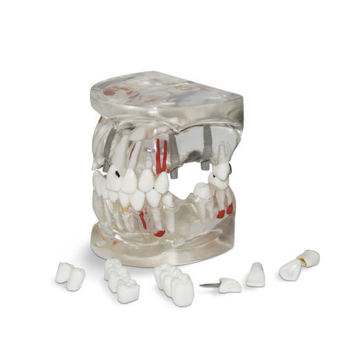 Modelo anatómico de nervio - T04 - GF DENTAL - mandibular / de dientes / de implantología
