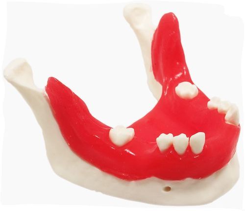 Modelo anatómico de mandíbula - E21/T - GF DENTAL - de implantología / de formación / rojo