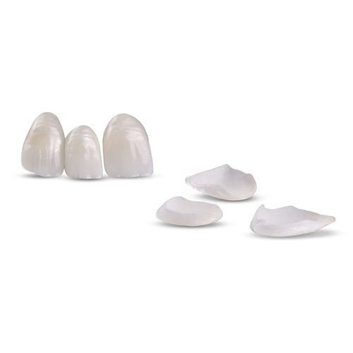 Material dental de cerámica - Veneers - Glidewell Europe - de circona / de disilicato de litio / para restauración dental