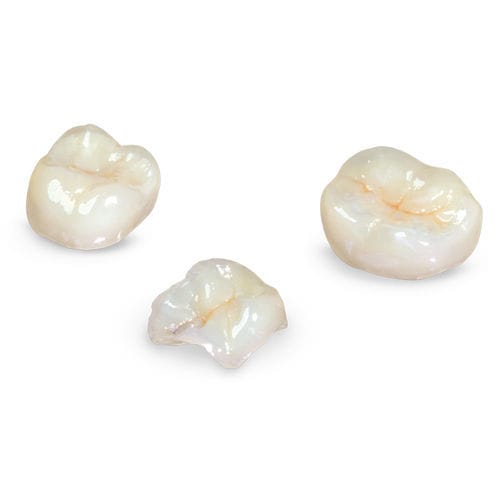 Material dental de composite - Glidewell Europe - para puente dental / para corona / para inlays dentales