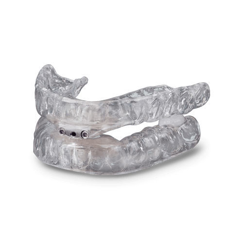 Dispositivo antirronquido férula - TAP® 3 TL - Glidewell Europe