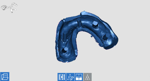 Software de captura - OPTORC - Open Tech 3D Srl - de adquisición / de ayuda a la prescripción / para odontología
