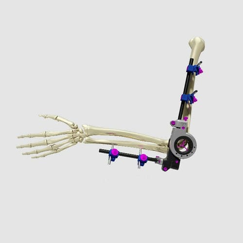 Fijador externo para codo - UniX® PDF - Response Ortho - tubular / para adulto