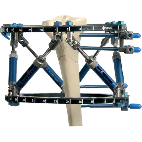 Fijador externo modular - Smart Correction®  - Response Ortho - circular / para adulto