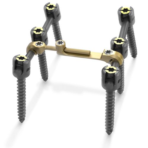 Sistema de osteosíntesis toracolumbar - Quantum® - RTI Surgical - vía posterior / para adulto
