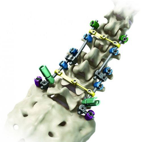 Sistema de osteosíntesis toraco-lumbo-sacro - Streamline® TL - RTI Surgical - vía posterior / para adulto
