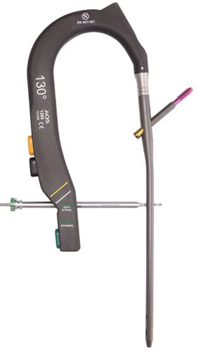 Clavo intramedular para trocánter - Galileo™  - AOS - Advanced Orthopaedic Solutions