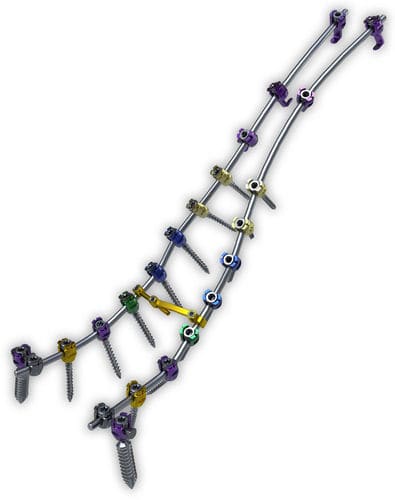 Sistema de osteosíntesis toraco-lumbo-sacro - Lancer™ - ChoiceSpine - vía posterior / para adulto