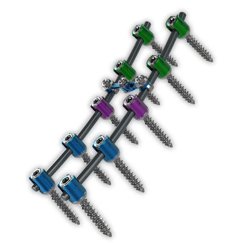 Sistema de osteosíntesis toracolumbar - Proliant® - ChoiceSpine - vía posterior / para adulto