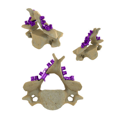 Placa para laminoplastia para vértebra cervical - Blackbird™ HLS - ChoiceSpine - metálica