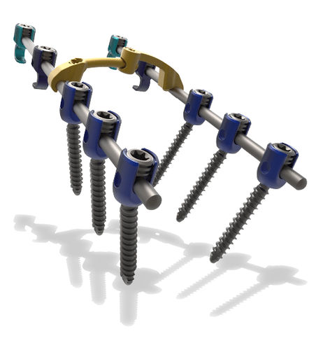 Sistema de osteosíntesis cervicotorácico - Blackbird™ - ChoiceSpine - vía posterior / para adulto