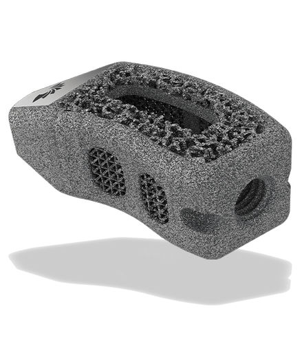 Caja intersomática lumbar - TigerShark® Threaded TL  - ChoiceSpine - vía transforaminal / de titanio / impresa en 3D