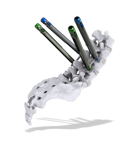 Sistema de posicionamiento de tornillos pediculares mínimamente invasivo - Thunderbolt™ - ChoiceSpine