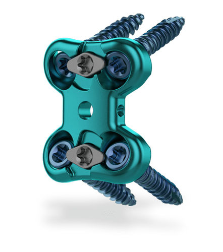 Placa de artrodesis lumbar - Raven®  - ChoiceSpine - 1 nivel