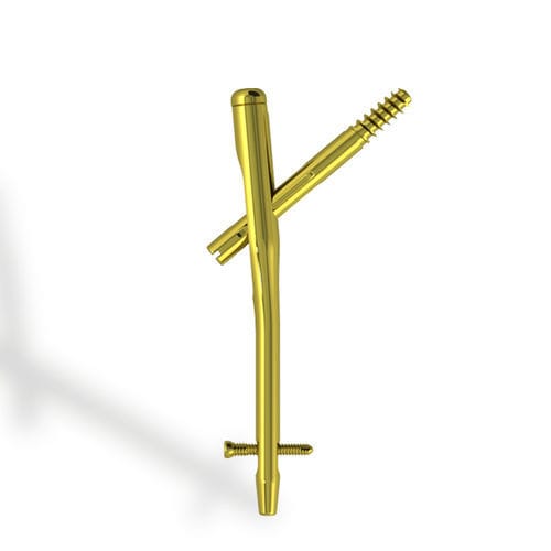 Clavo intramedular para fémur - EBA ONE - Citieffe - fijación proximal / de titanio