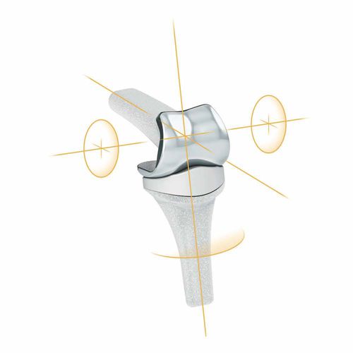Implante interfalángico de la mano - PIPR™ - MatOrtho