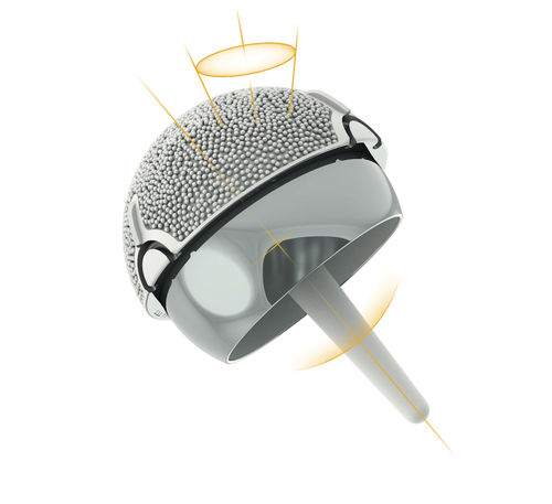 Prótesis de cabeza femoral - ADEPT® - MatOrtho