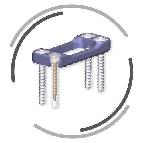 Placa de artrodesis toracolumbar - CONTACT - Signus Medical - anterolateral / de titanio