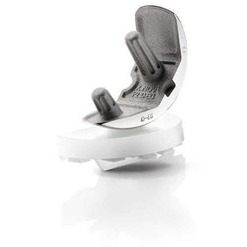 Prótesis de rodilla unicompartimental - KAPS®Full PE - X-NOV Medical Technology - de platillo fijo