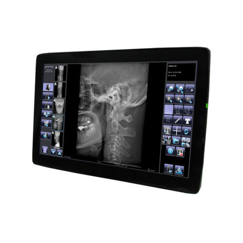 Sistema de adquisición para radiología - Primo  - ATS - Applicazione Tecnologie Speciali
