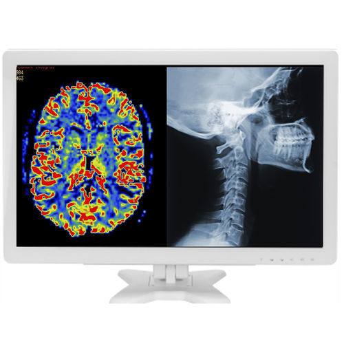 monitor para endoscopia - BriteMED Technology