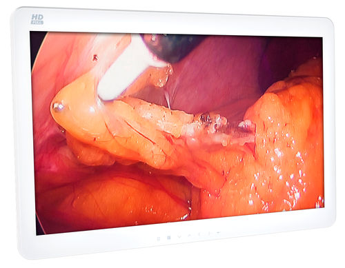 Monitor médico - MEGABYTE Systemhaus GmbH - quirúrgico / Full HD / 4K