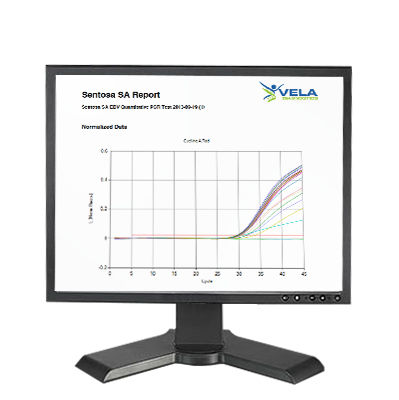 Software de análisis - Sentosa SA - Vela Diagnostics - de interpretación / de biología molecular