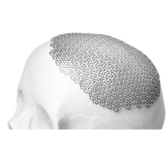 Implante craneal - BioMesh®  - Bioplate